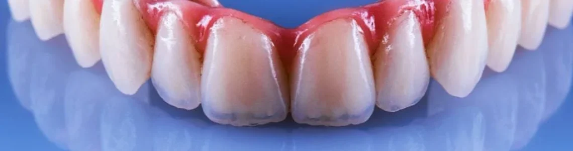 Proteza-fixa-cu-4-sau-6-implanturi-dentare.jpg