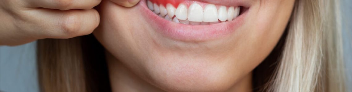 gum-inflammation-closeup-young-woman-showing-bleeding-gums-gray-background-dentistry-1024x683